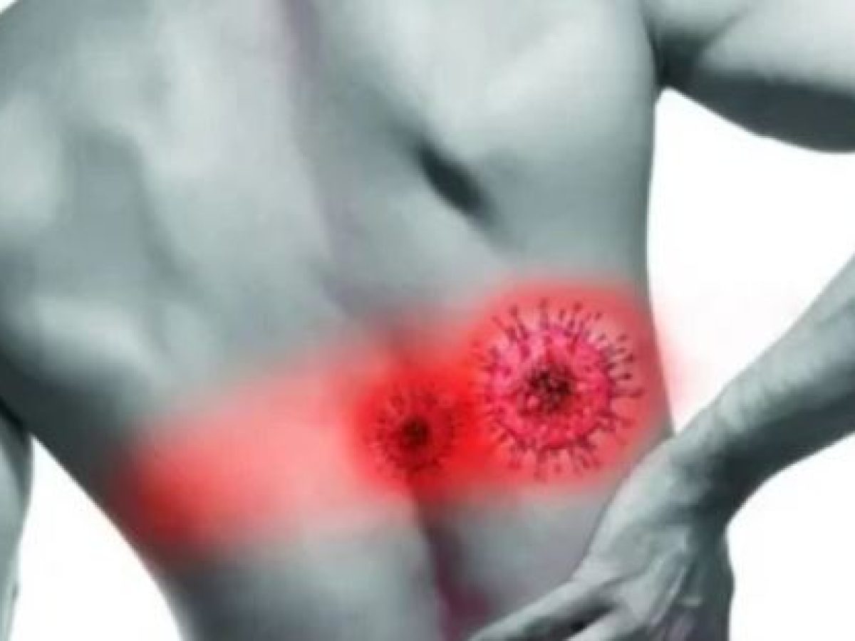 Έρπης ζωστήρας: Ποιοι κινδυνεύουν περισσότερο και πώς εκδηλώνεται